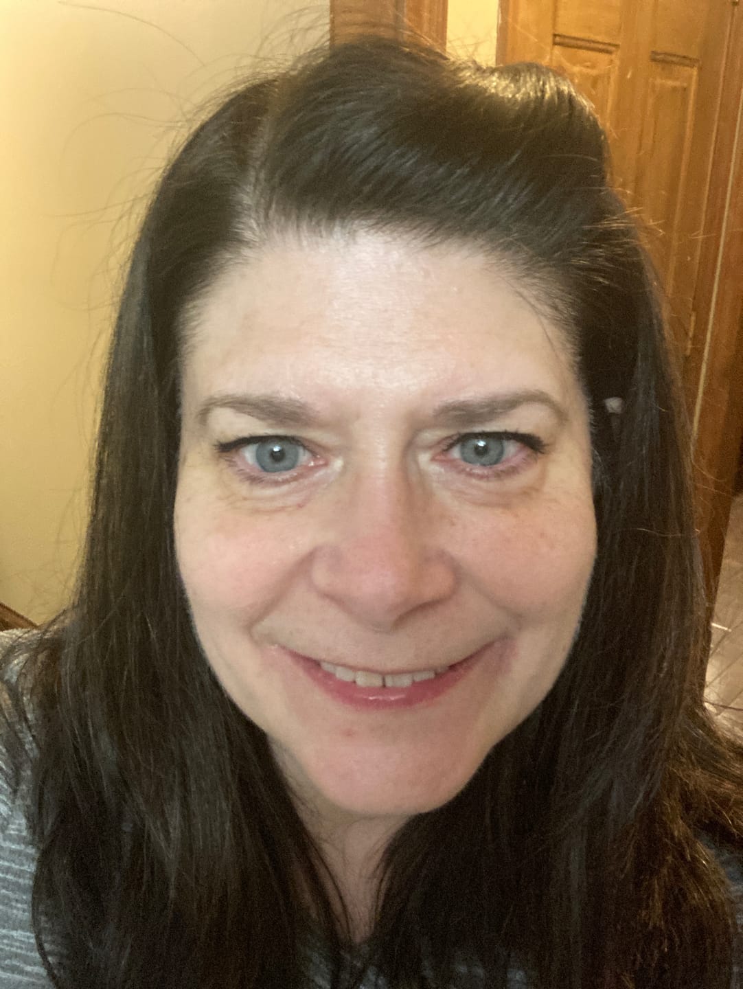 Customer photo review of Glov Micro Infusion System