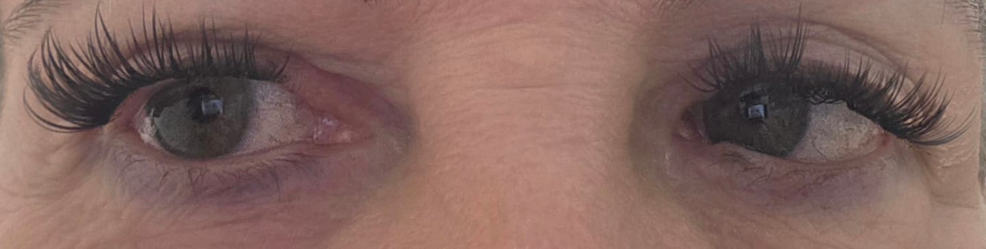 Customer photo review of Infinaluxe Applicator Cleansing Wipes x 3