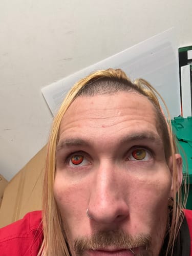 Close-up of a reviewer wearing the Cosplay Anime contact lenses, with one bright red lens and one greenish-brown lens.