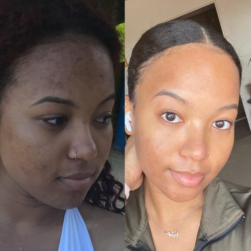 Customer photo review of Kojic Acid Turmeric Night Wrapping Mask