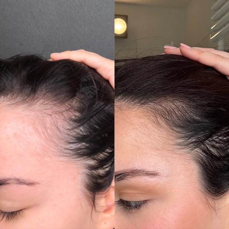 Customer photo review of שמן לצמיחת השיער של NOVELA