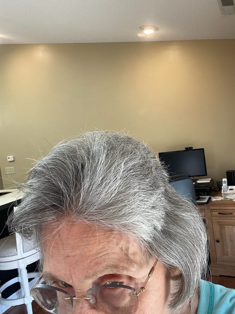 Customer photo review of Hair Growth Hero Bundle