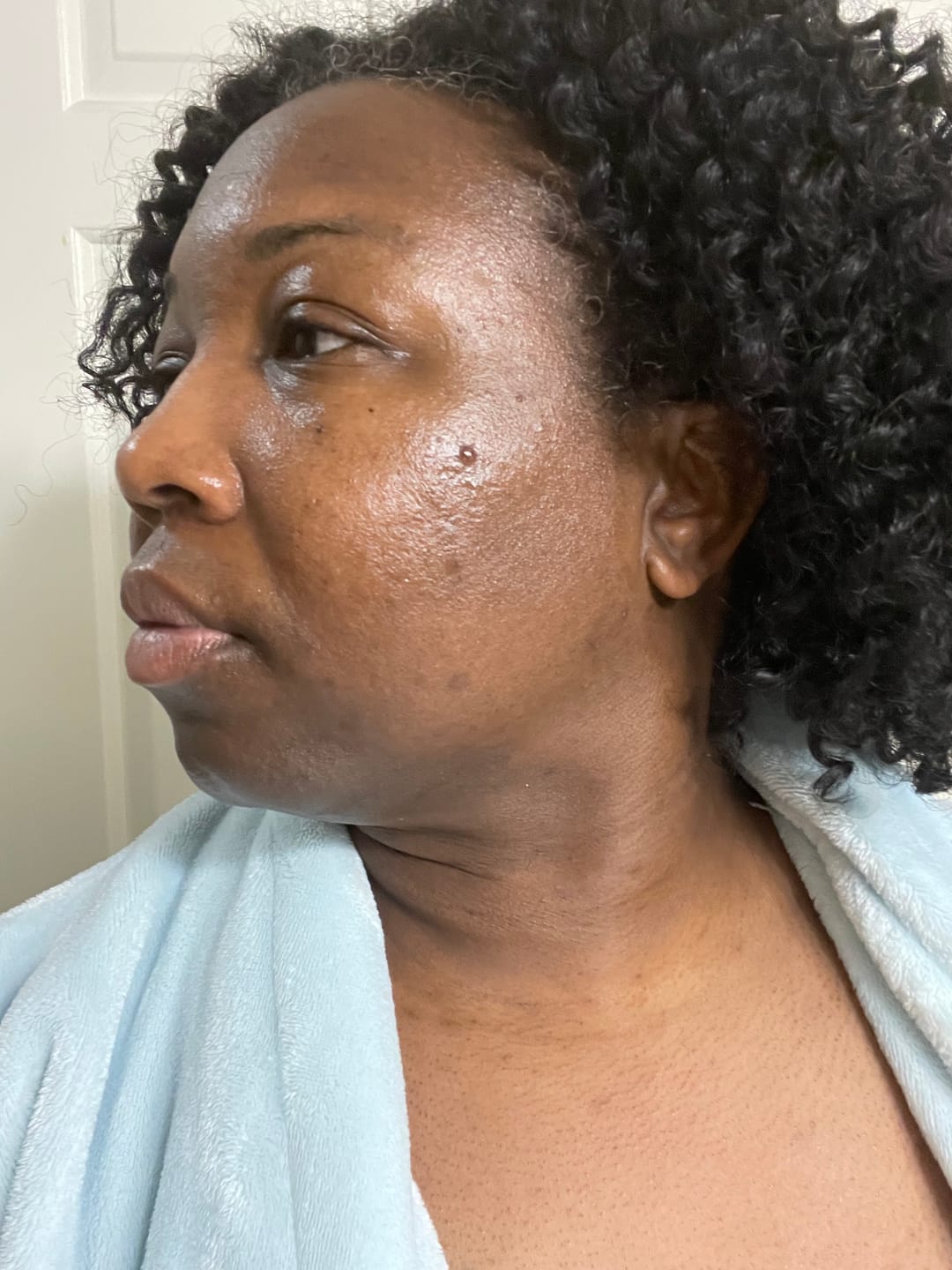 Customer photo review of Glass Skin Face Kit