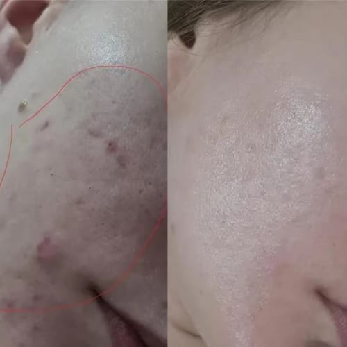 Customer photo review of Kojic Acid Turmeric Night Wrapping Mask