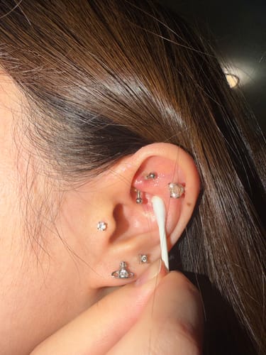 Customer photo review of Piercing Bump Treatment - Bump, Keloid & Scar Relief Oil