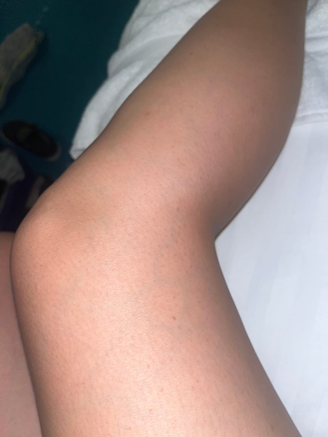 Customer photo review of Guante Exfoliante