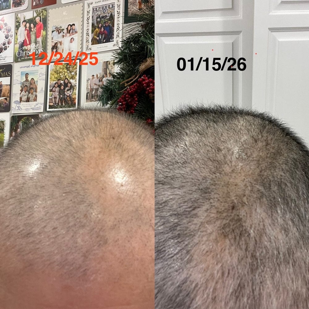 Customer photo review of Bloom: Hair Growth Oil