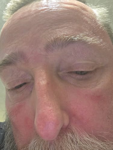 Customer photo review of Seb Natural Soothing Balm