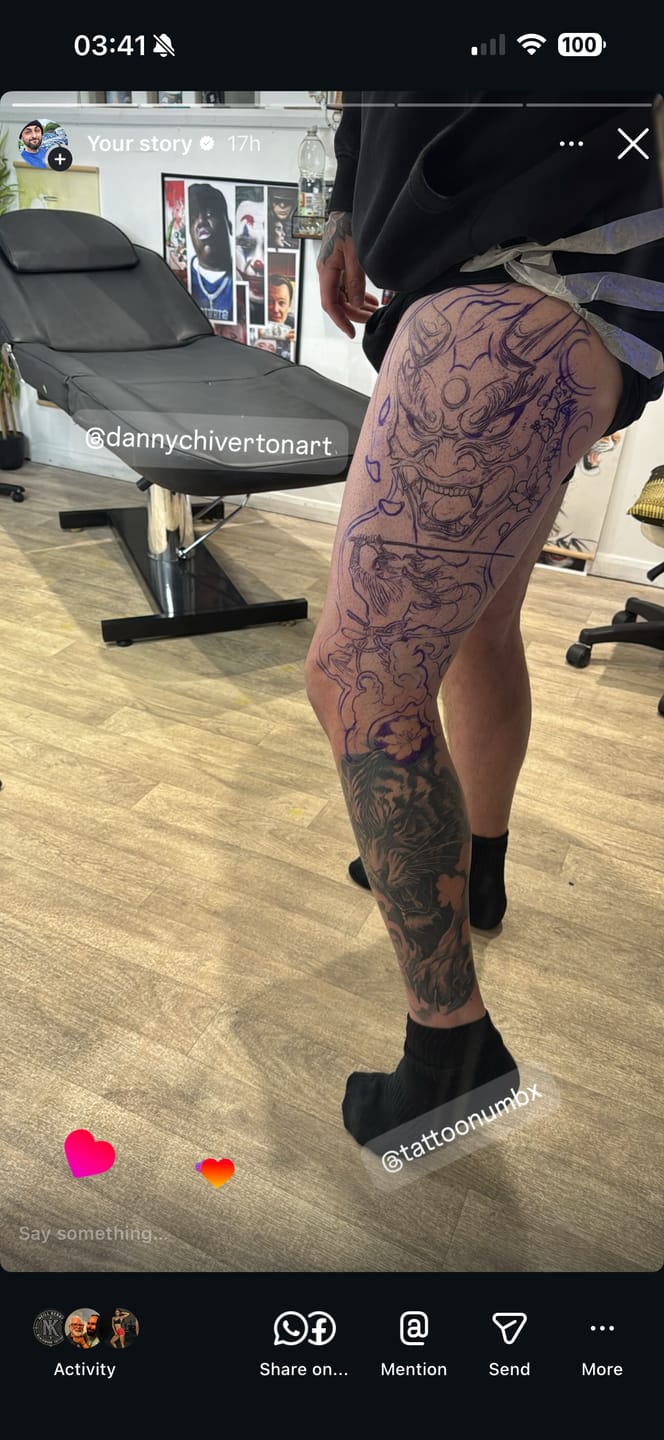 Customer photo review of TattooNumbx Tattoo Bundle