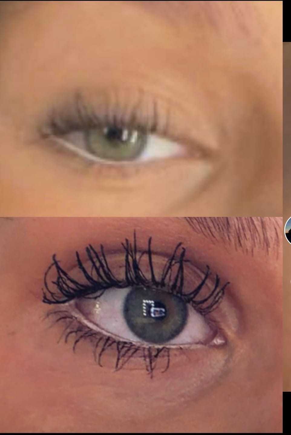 Customer photo review of Eyelash Growth Serum