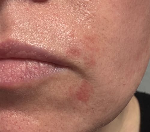 Customer photo review of Seb Natural Calming Serum