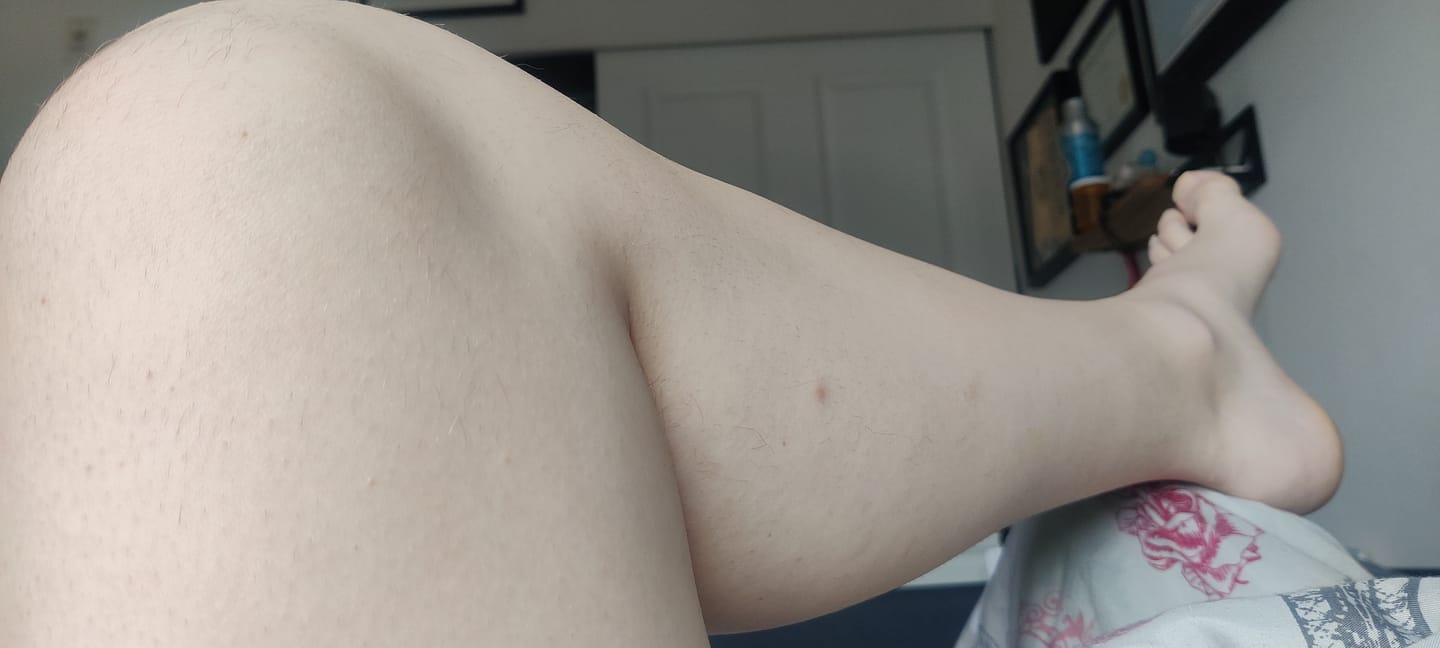 Customer photo review of Bumzzy Butt Shaver 2.0