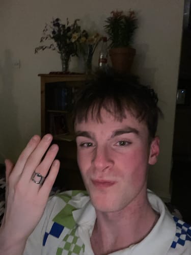 Customer photo review of Bottle Opener Ring
