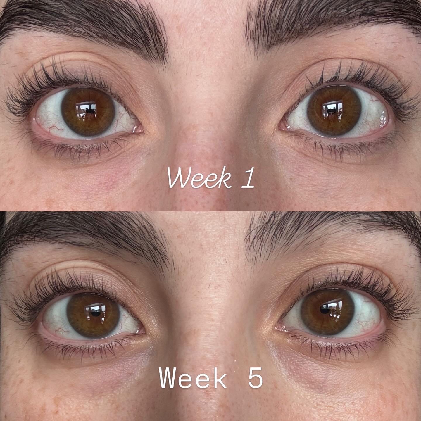 Customer photo review of Eyelash Serum