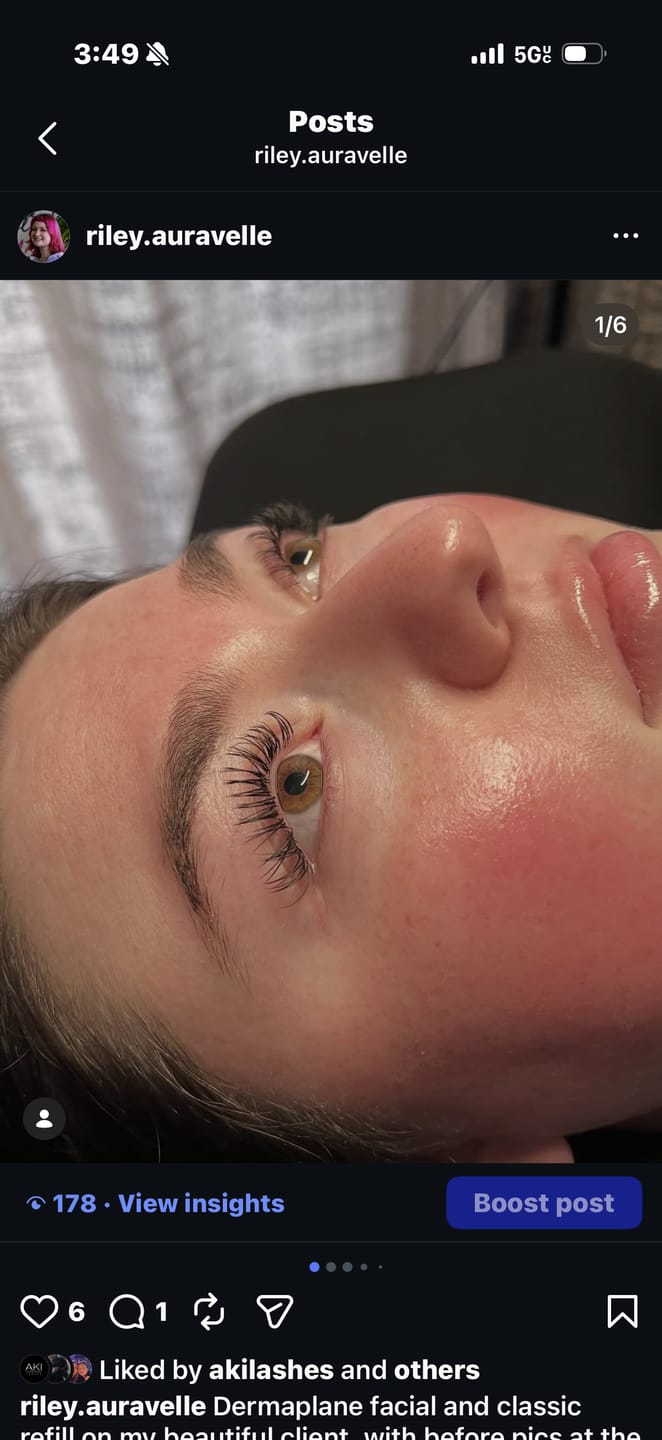 Customer photo review of EYELASH EXTENSION GLUE: THOUSANDLASHES’ ULTRA CRYSTAL BOND