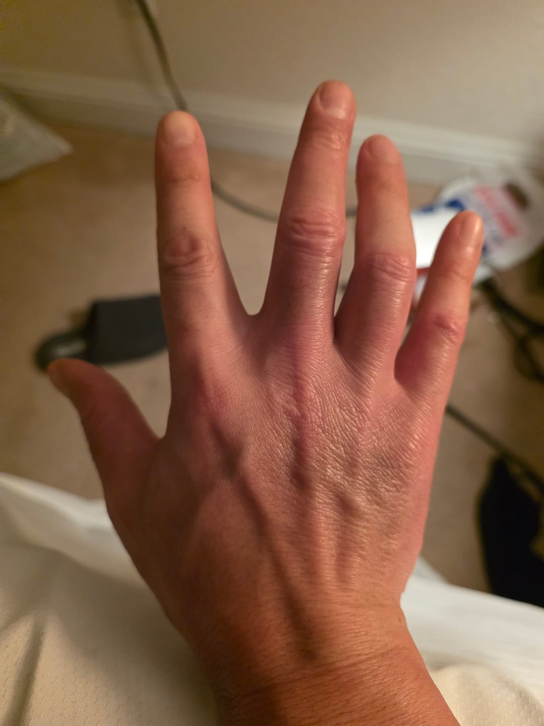 Customer photo review of EczPro - Probiotics for Eczema, Natural Remedy, 13 Histamine-Safe Strains, Allergen-Free Formula