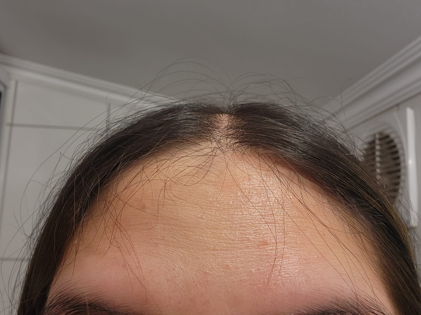 Customer photo review of Pack Anticaída de Cabello para 1 Mes