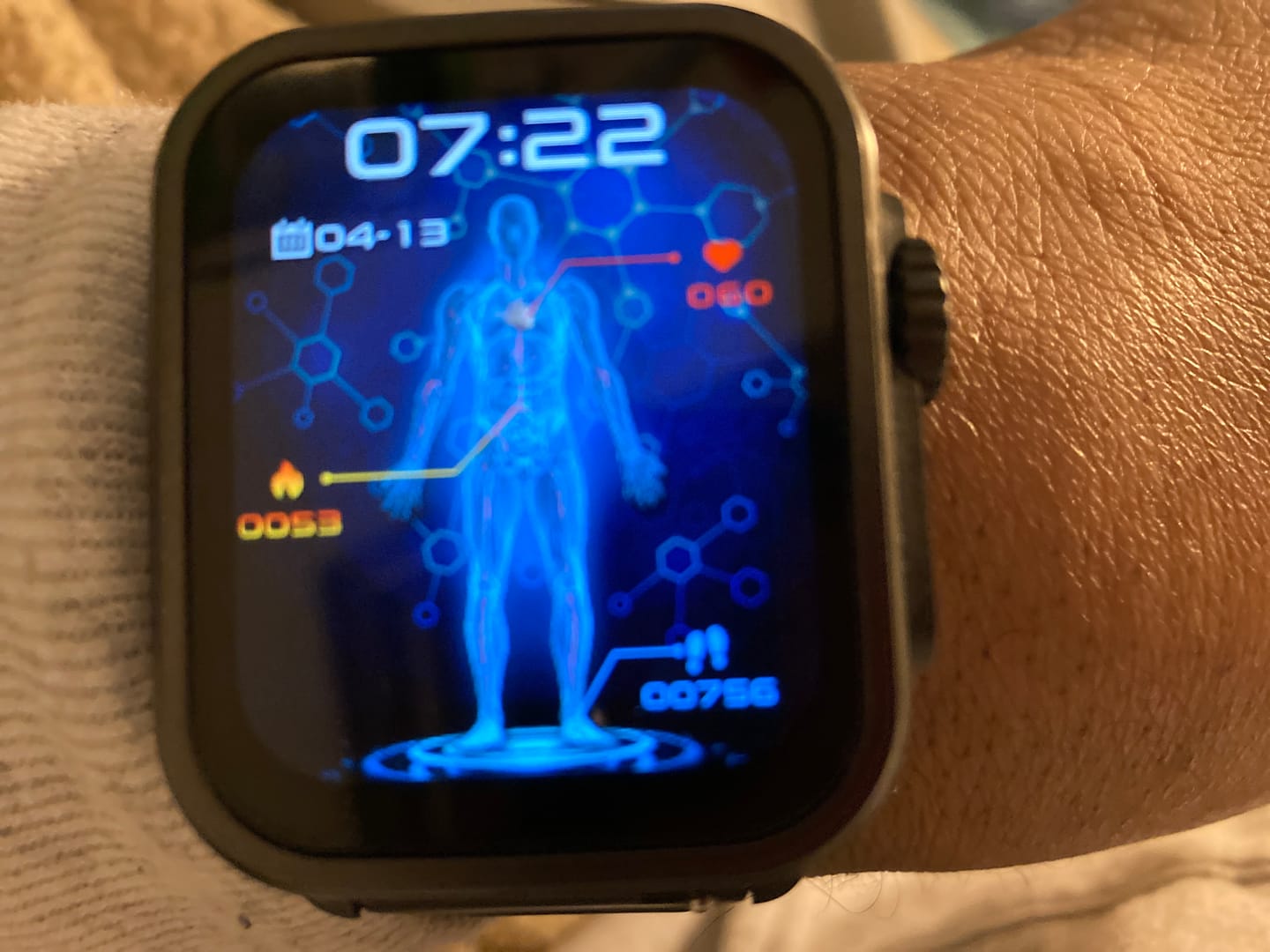 Customer photo review of Fitaos VEE ECG/EKG Blood Glucose Blood Oxygen Heart Rate Monitoring Sport SmartWatch