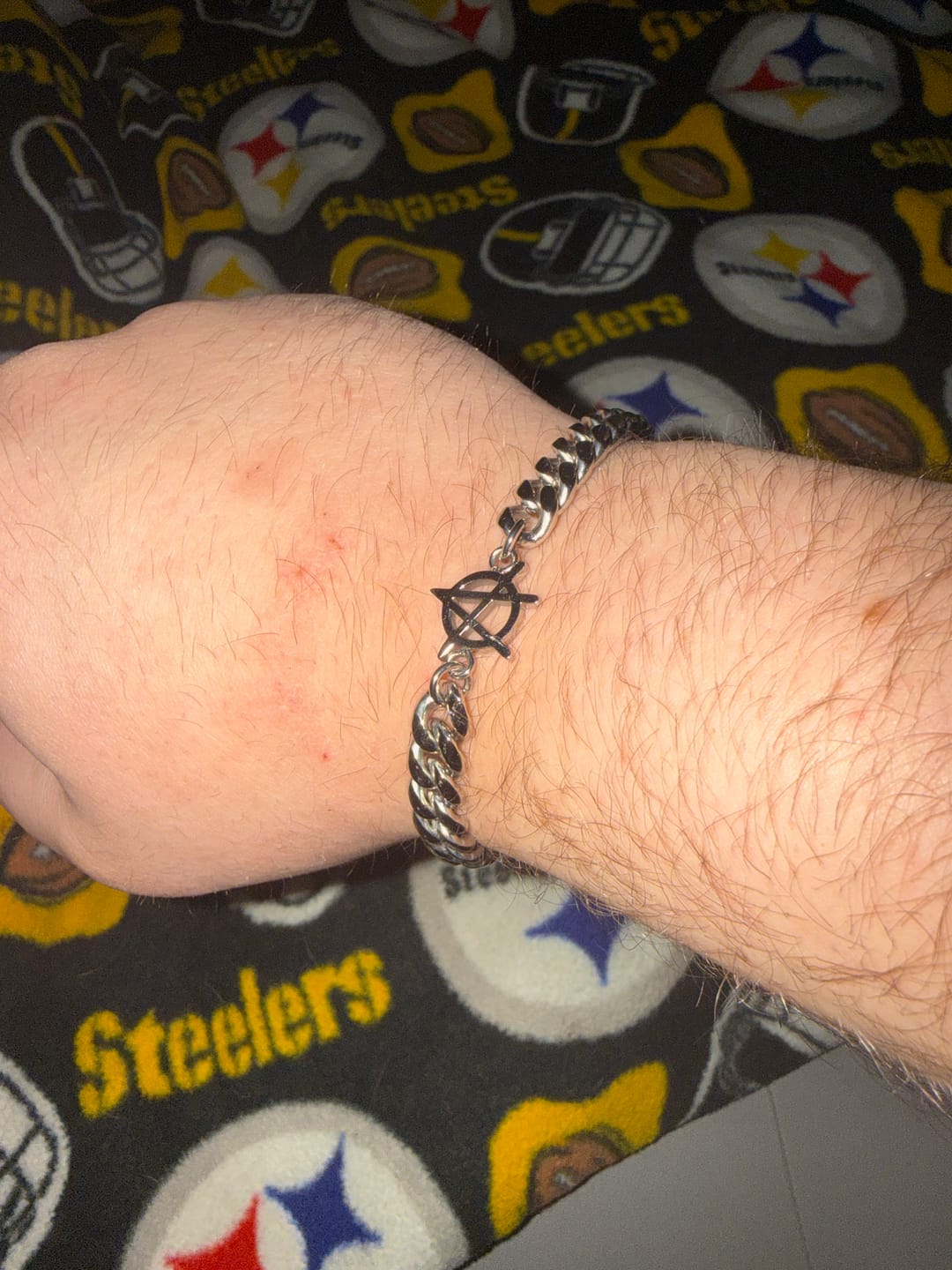 Customer photo review of ANARCHY CUBAN BRACELET