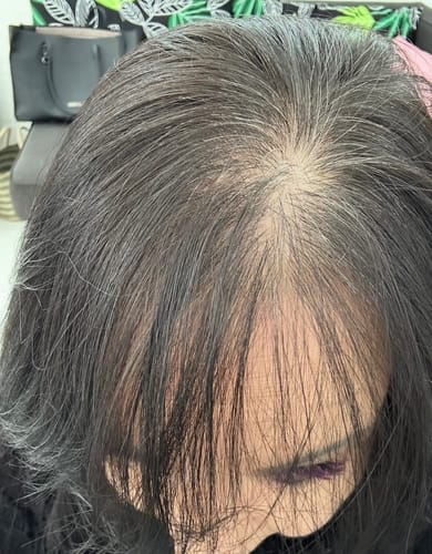 Customer photo review of Hair & Nail Capsules