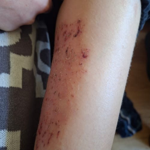 Customer photo review of Seb Natural Calming Serum