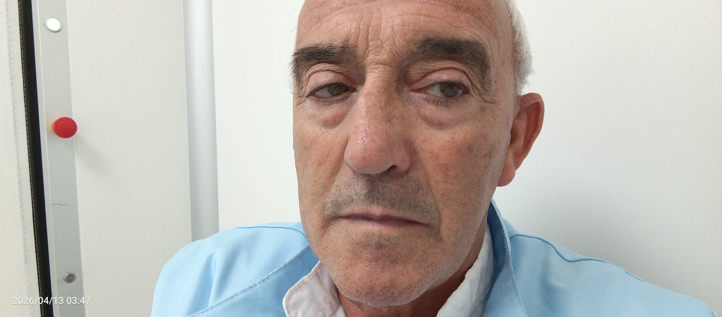 Customer photo review of OMEN Serum anti-edad para Hombre