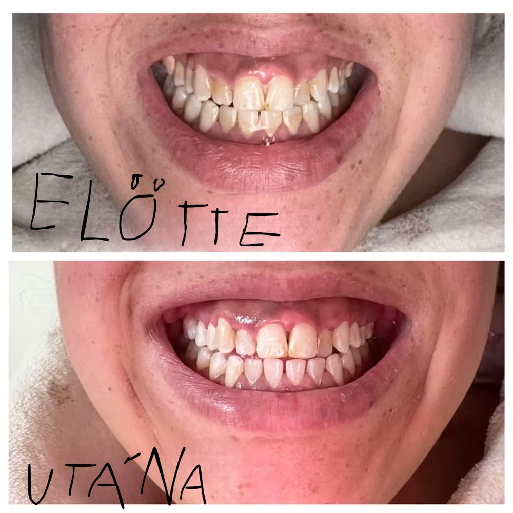 Customer photo review of Zaluna ultrahangos fogtisztító