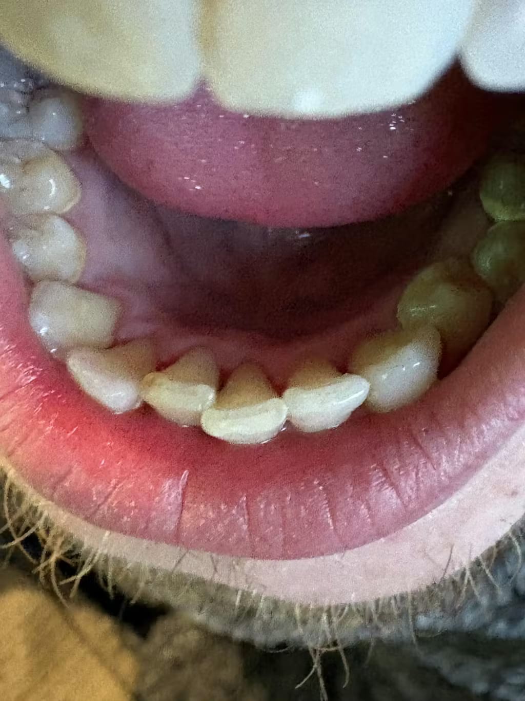 Customer photo review of Zaluna ultrahangos fogtisztító