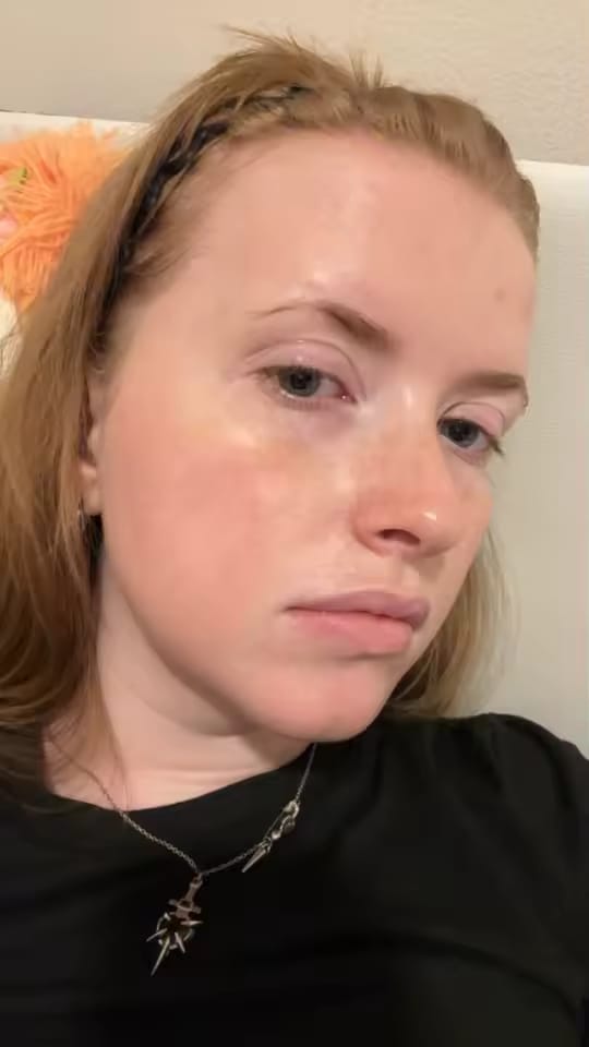 Customer photo review of PERLE C – Gel con capsule di vitamina pura illuminante