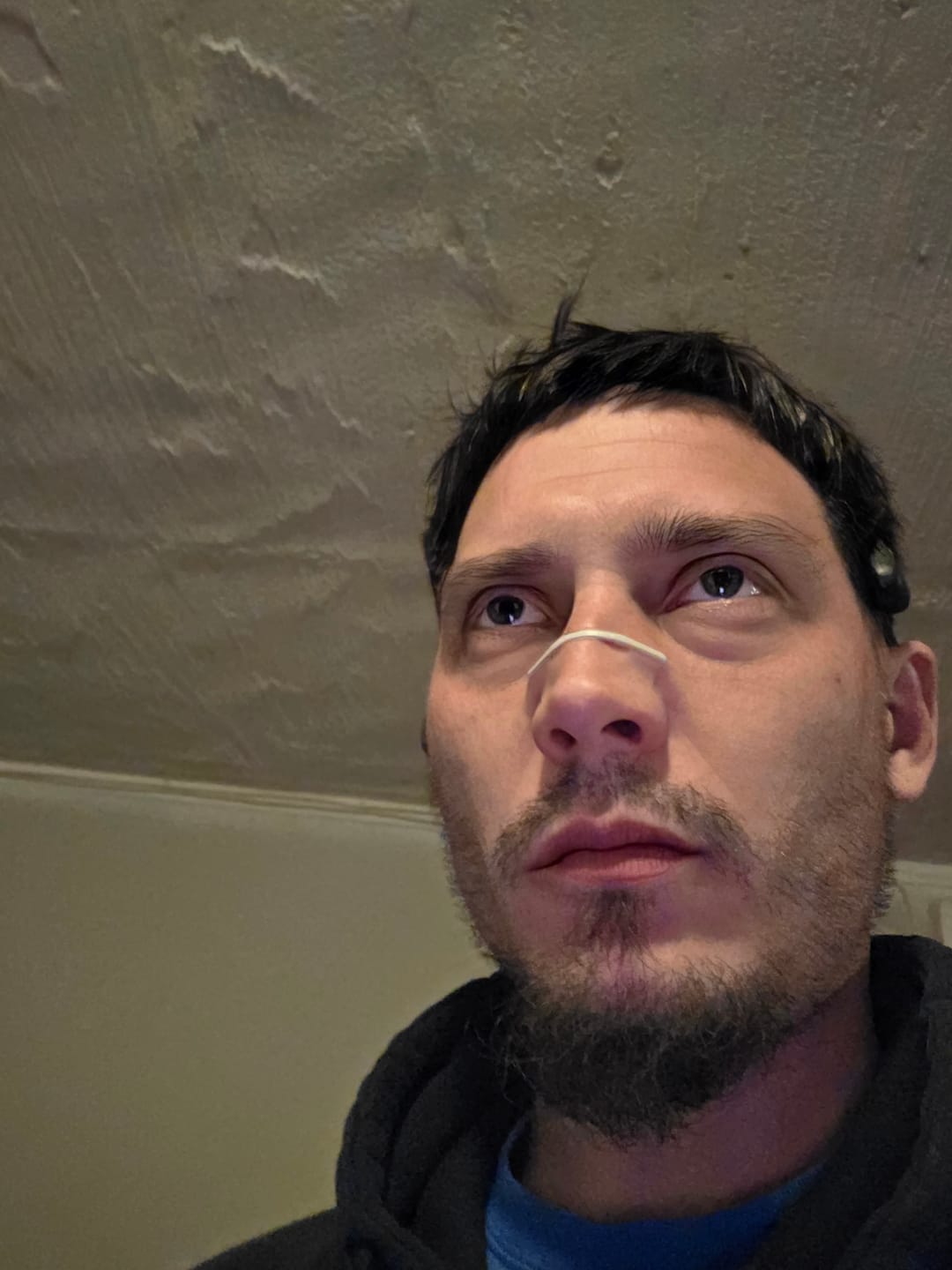 Customer photo review of Second Wind Nasal Strips