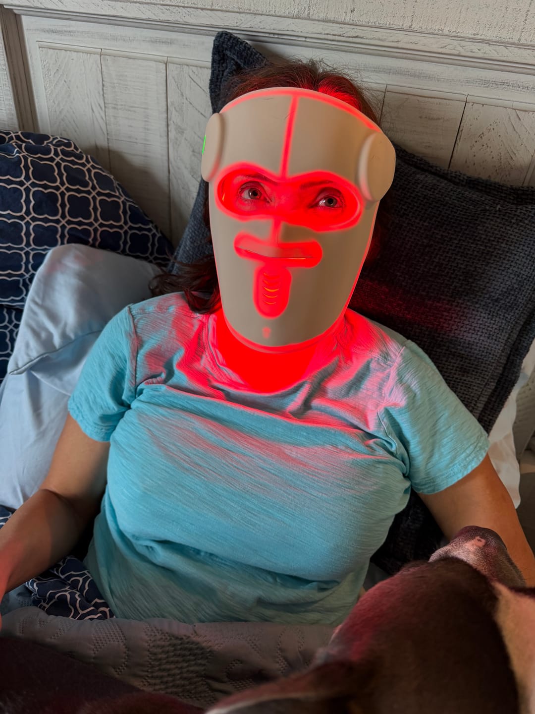 Customer photo review of Hatch Halo™ Dermatologist Grade 3-in-1 Light Therapy Mask
