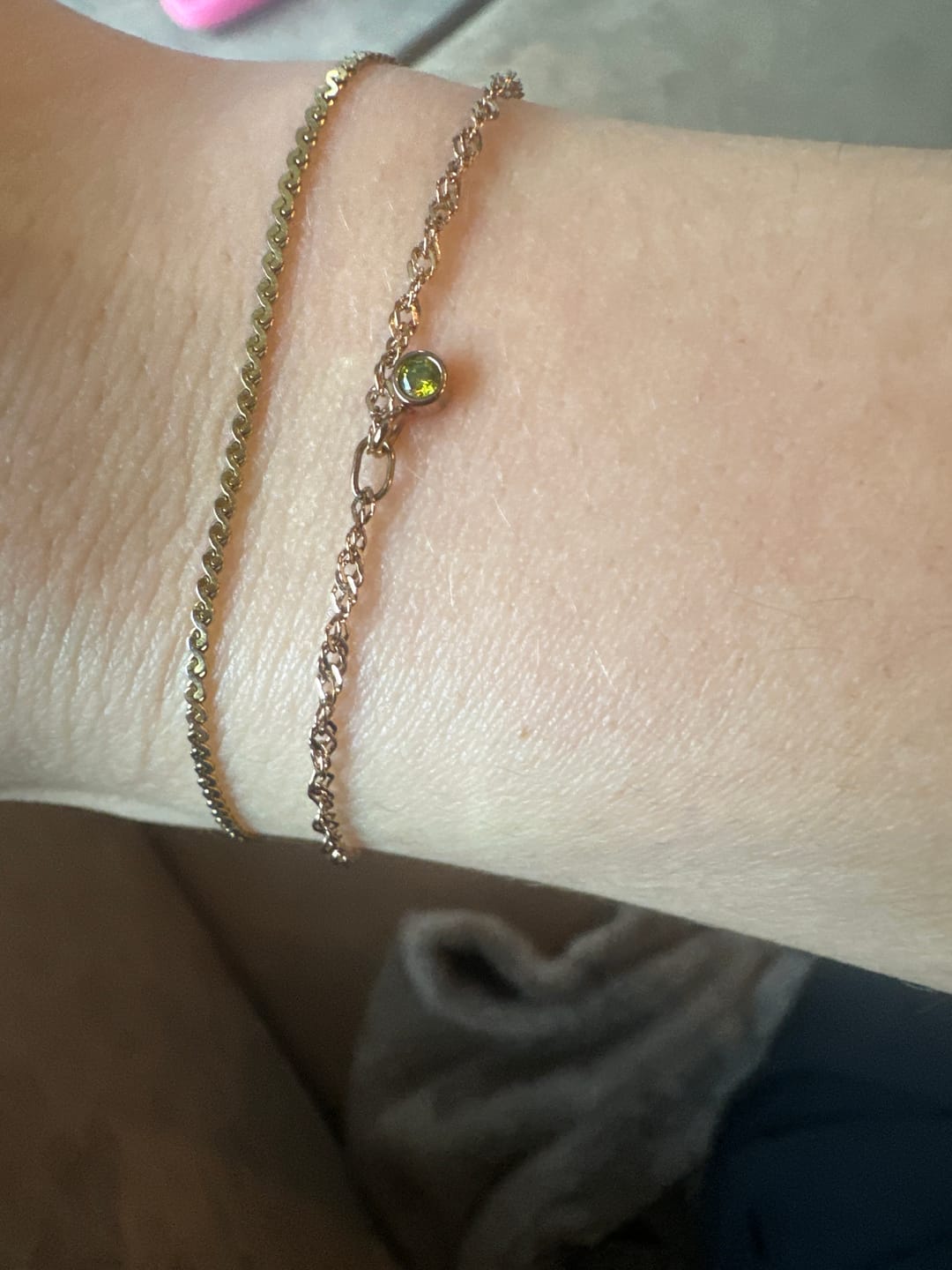 Customer photo review of Permanent Armband - dein everbond in München