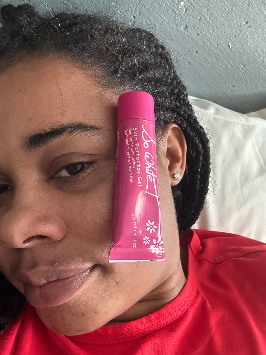 Customer photo review of Fair And White So White Skin Perfector Dark Spot Corrector Gel 30ml / 1 fl oz