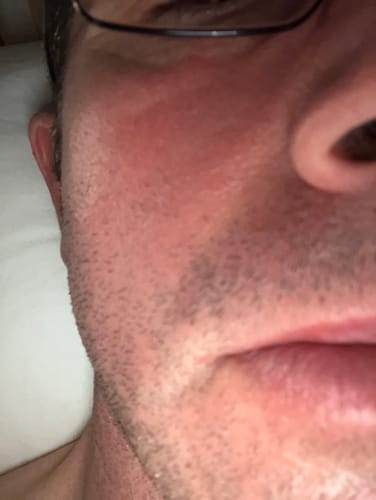 Customer photo review of Seb Natural Soothing Balm