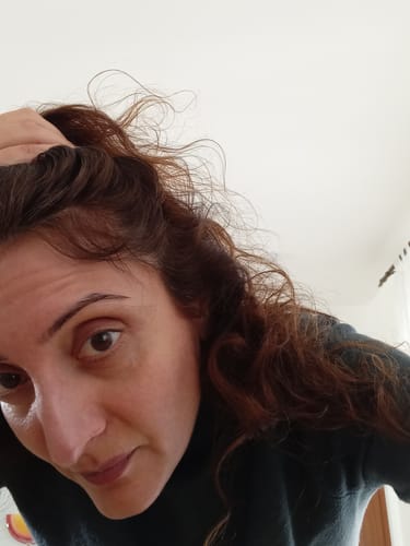 Customer photo review of VITAFOAM ™ Hair Growth Formula