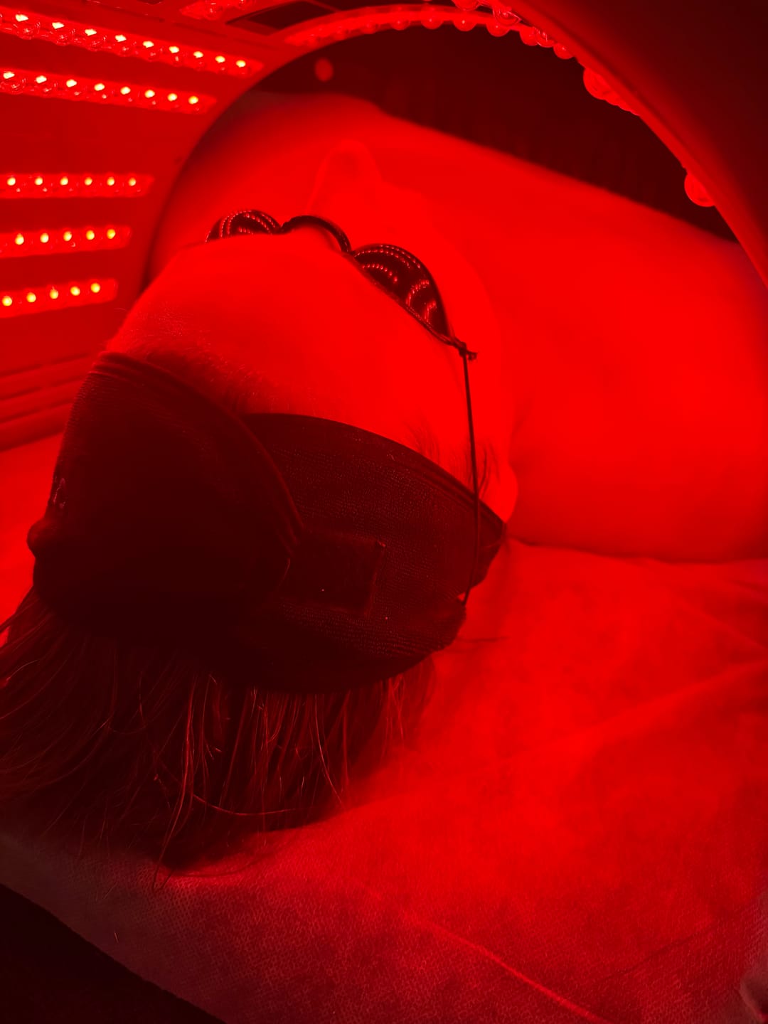 Customer photo review of Peachaboo LED Light Therapy Pod
