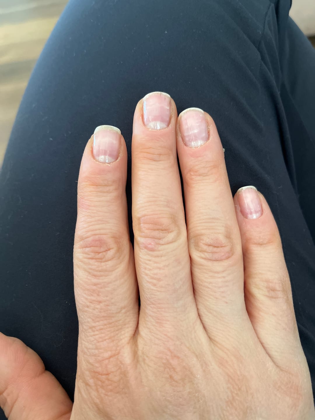 Customer photo review of Ohora Tırnak Güçlendirici
