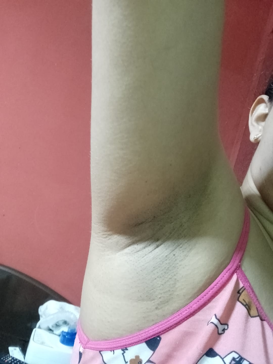 Customer photo review of DermoSec Roll-on Compre 1 Leve 2