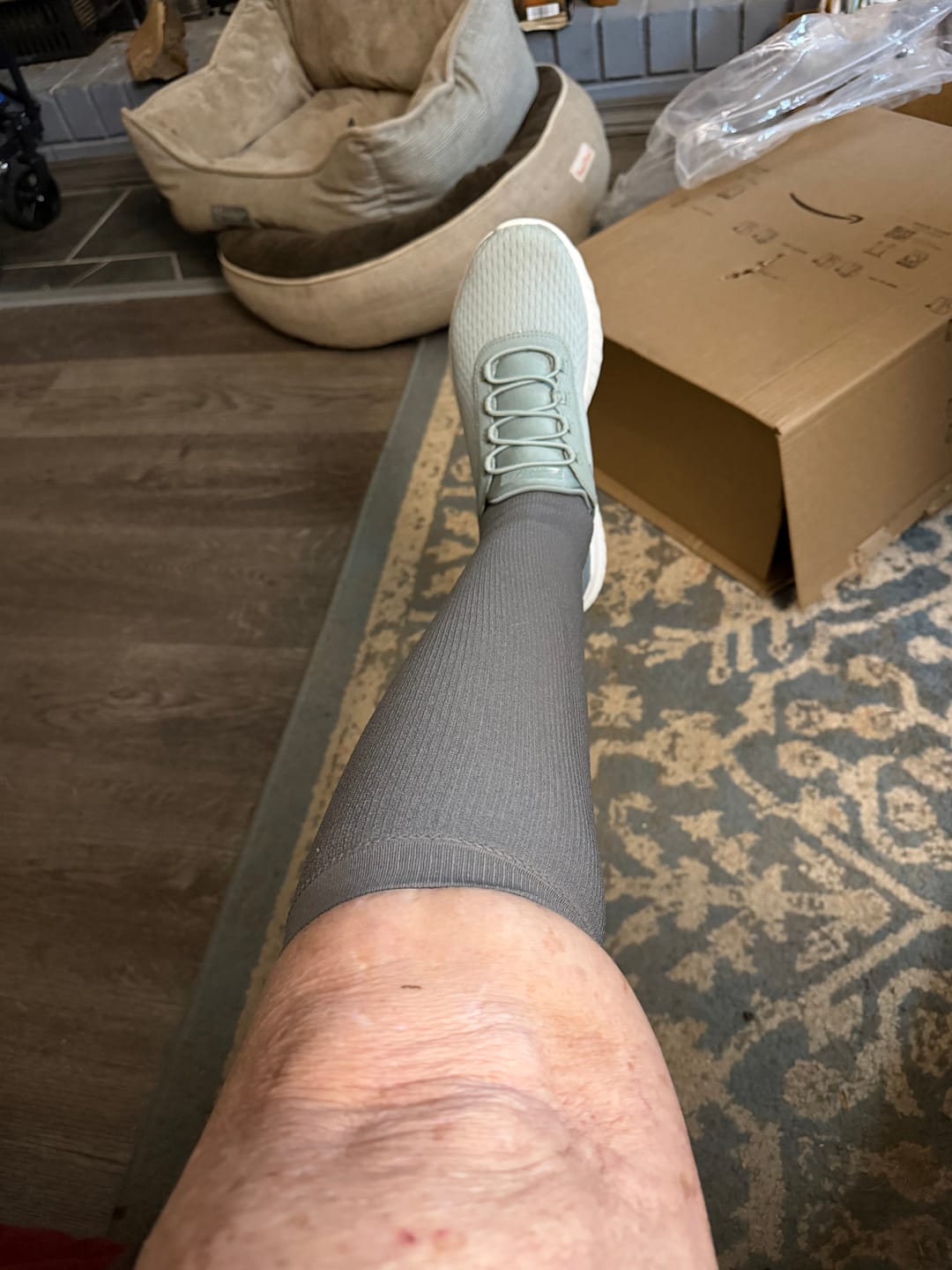 Customer photo review of EverSock™ Wide Compression Socks For Pain Relief
