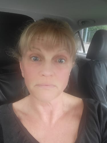 Customer photo review of Alastin Regenerating Skin Nectar 29.6ml / 1.0fl oz