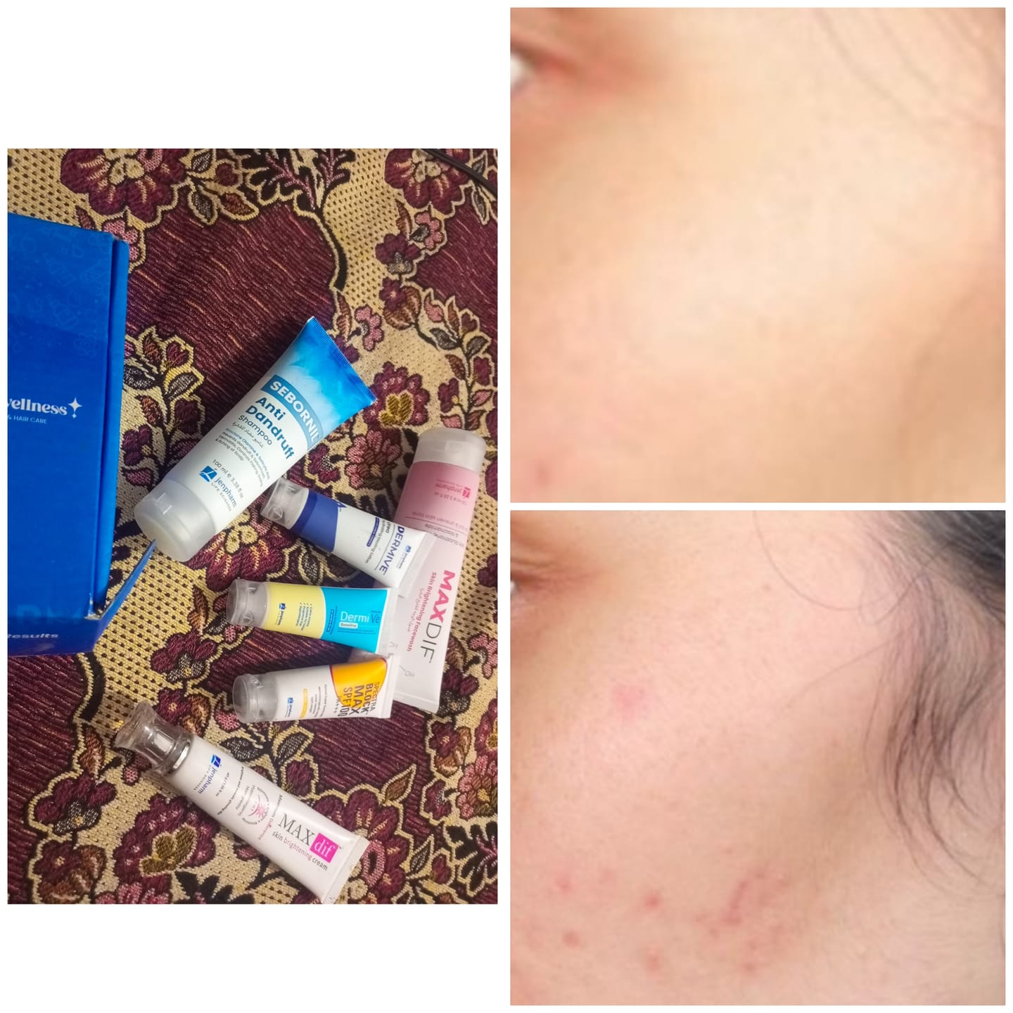 Customer photo review of Maxdif Brightening Cream