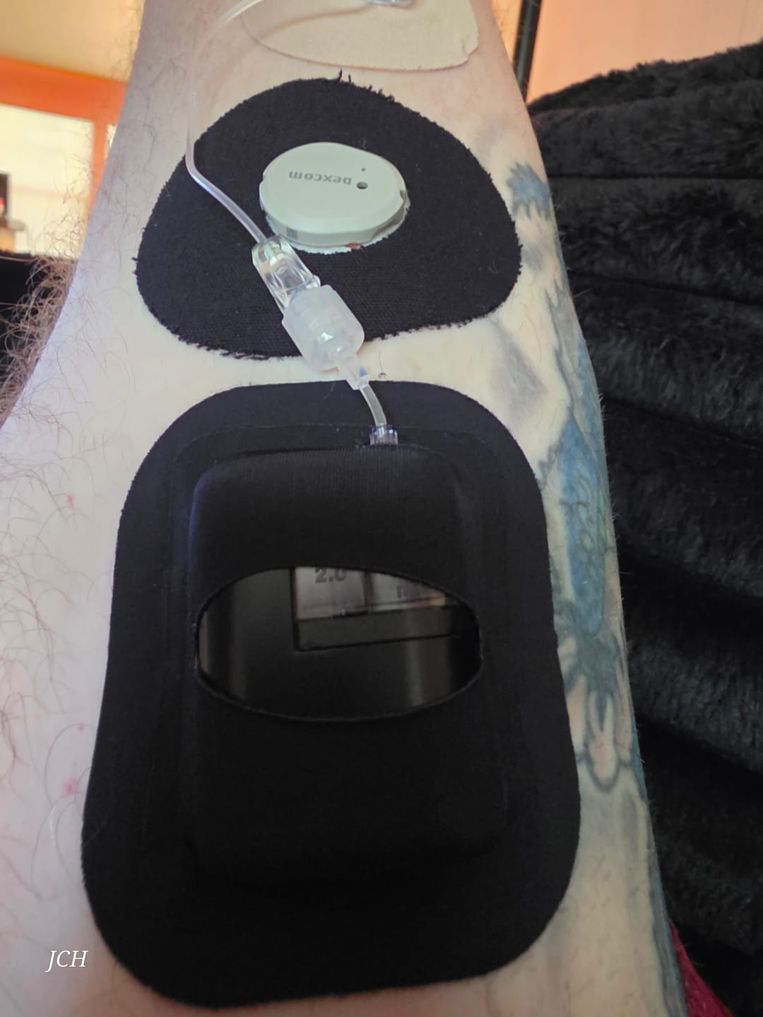 Customer photo review of Skin Grip - Tandem Mobi Pocket Patch