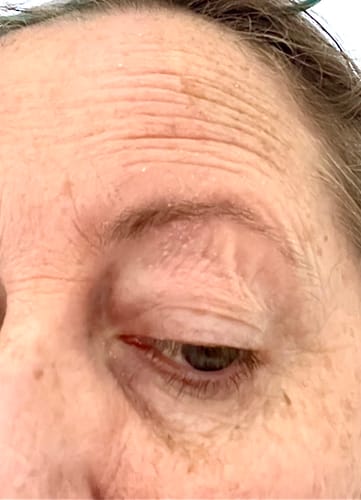 Customer photo review of Seb Natural Calming Serum