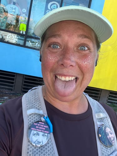 Customer photo review of Gold Glitter Freckles Makeup Patches