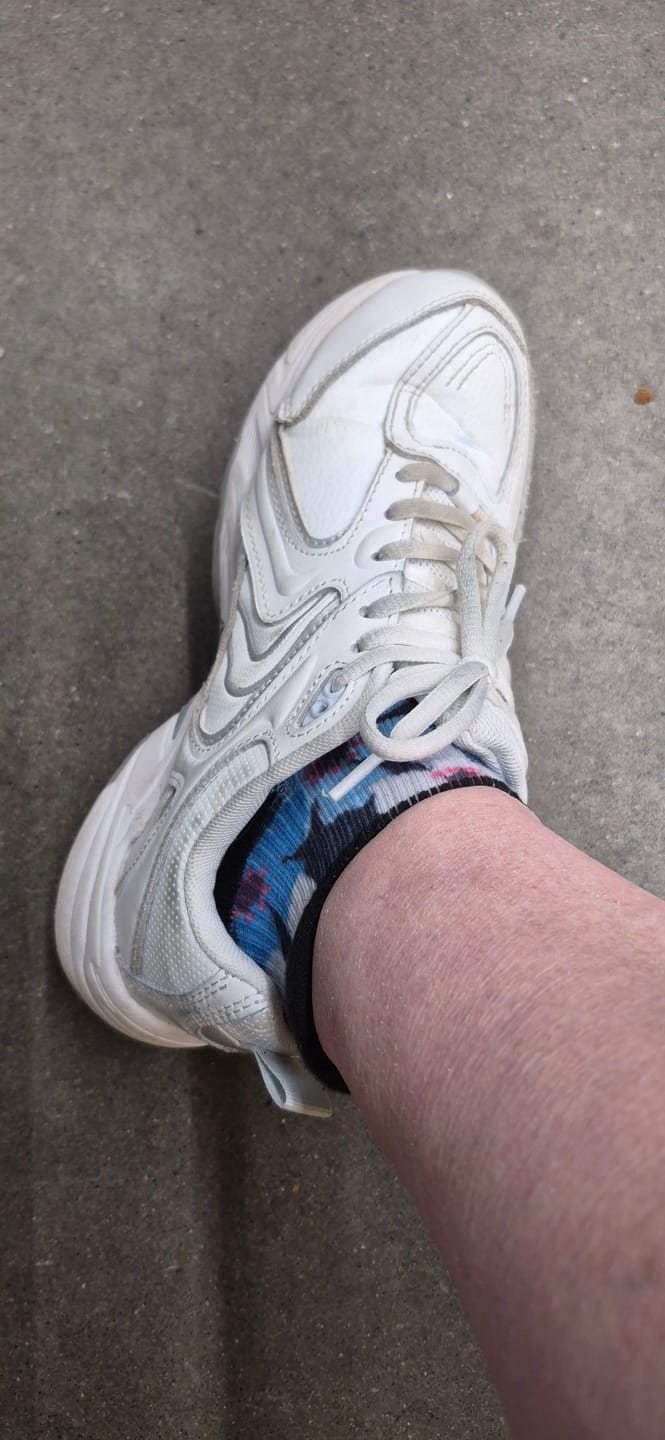 Customer photo review of Ankle Compression Buy 1 Get 2 Free Mystery Offer