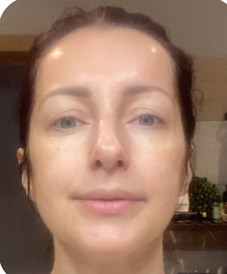 Customer photo review of Ādu nostiprinošs krēms Centellian24 Madeca Cream Time Reverse Season