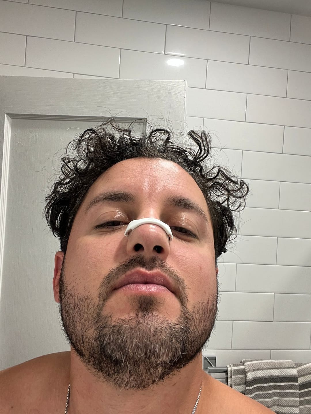 Customer photo review of Docamark™ Sporcu Burun Açıcı