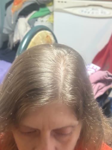 Close-up of a reviewer's scalp visible along their hair part after using the Natural Rosemary & Keratin Shampoo.