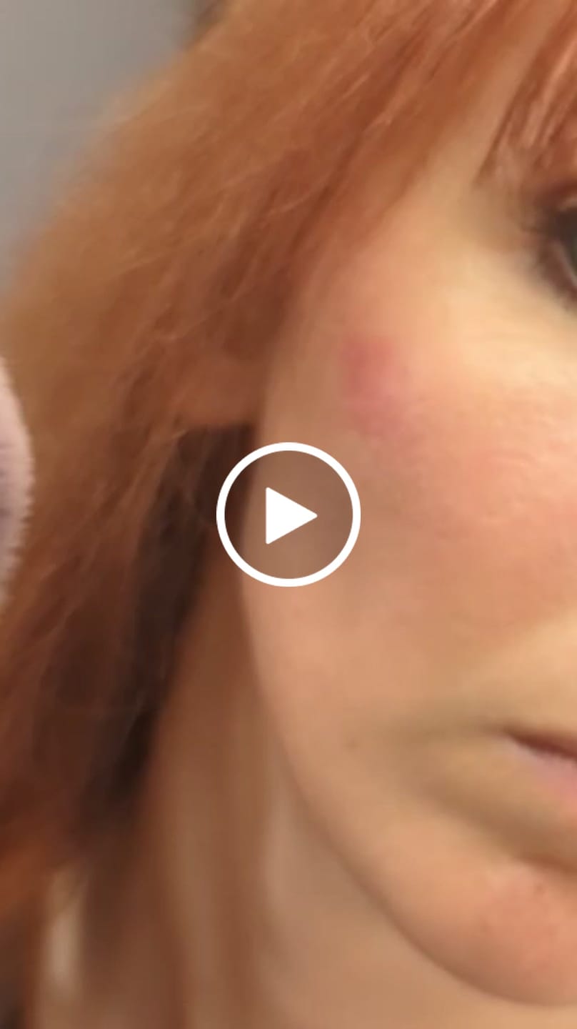 Customer video review of Bringebærlepper