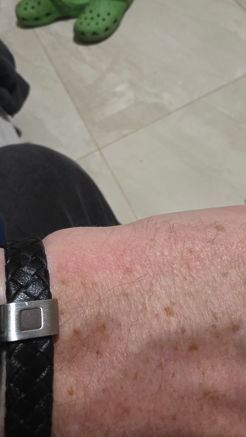 Customer photo review of The Energy Bracelet